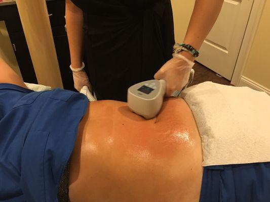 Fat Reduction and Skin Tightening with Exilis Ultra