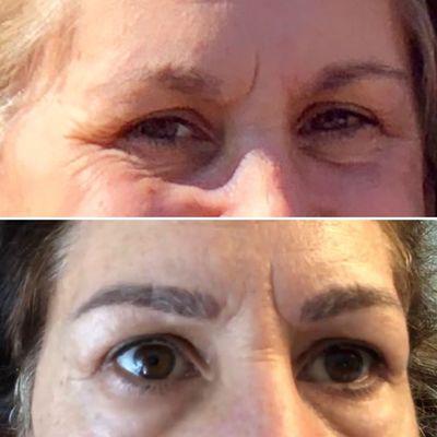 before: penciled eyebrows, after: 1 week post microblading