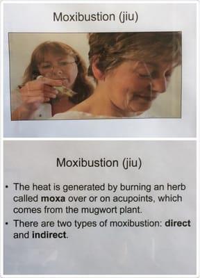 The theory of Moxibustion (jiu)