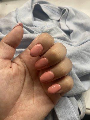 Ugly nails