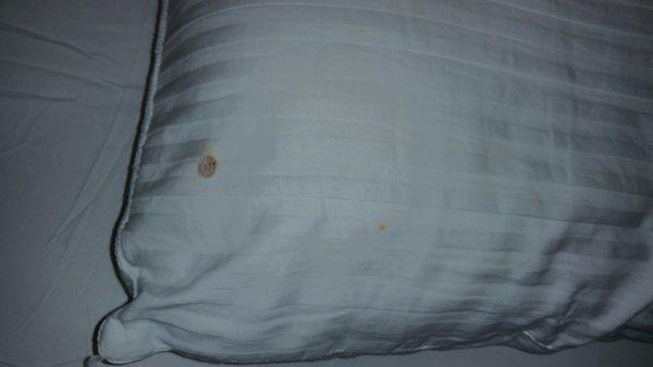 Cigarette burns in pillow