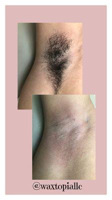 Male Underarm Wax