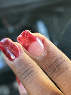 Mix Match pattern, (not asked for) and bleeding below the nail.