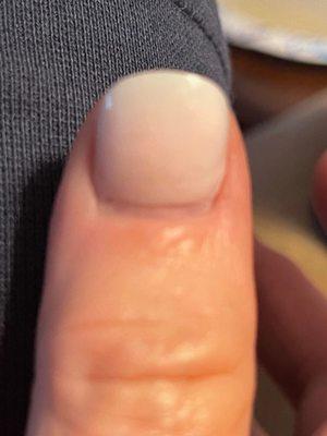 Too much space between cuticle and nail