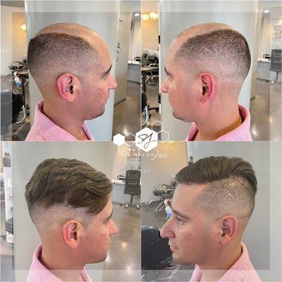 Non-surgical Men's Hair System services now offered