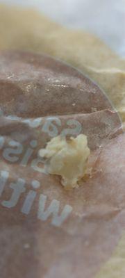 Piece of bone found in McChicken  Sandwich