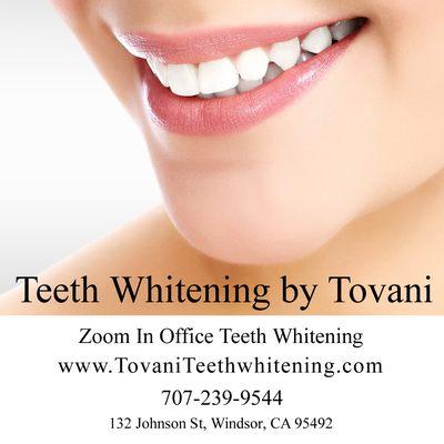 Zoom Teeth Whitening in Windsor by Donna Tovani Windsor California, Whiter Teeth with Zoom Teeth Whitening.