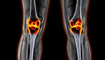 Total-Knee-Replacement-Prescott-Orthopedic-Surgeon #DavisOrthopaedics