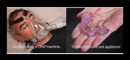 CPAP vs. Oral Appliance