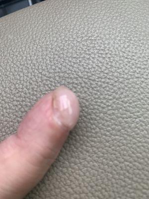 Example of nail product chipping & cracked after 7 days