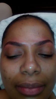 Threaded Eyebrow