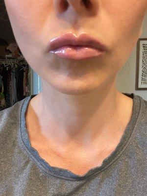 Lips by Angela @natural medicine and chiropractor.