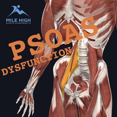 One of the most commonly misunderstood conditions. What causes it? Not your psoas...