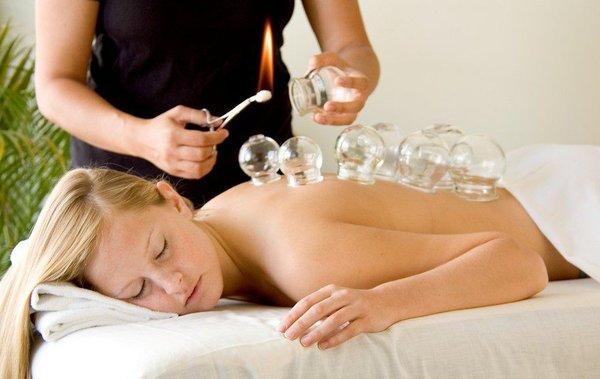 Cupping therapy