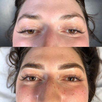 Microblading and Freckles