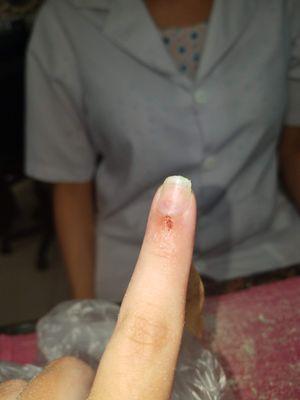 This is what they did to my 14 year old's finger taking off nails. We were the only customers! Not busy...I see now why!