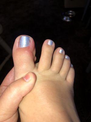 Pedicure Progession Photo