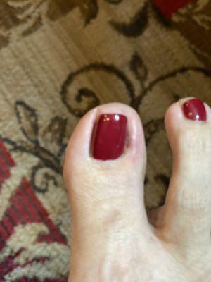 photo of toe infection from Lux Nails & Spa 8/21/21