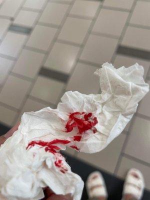 Some blood from my injury I got inside this store