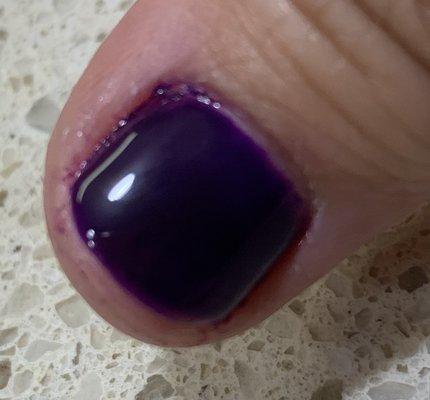 Polish on thumb cuticle she refused to clean