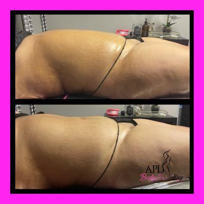 Single session infrared sauna and Laser Lipo