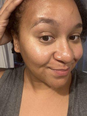 Day-after skin (muchhhh better results than the first go). Thanks, Kayla!