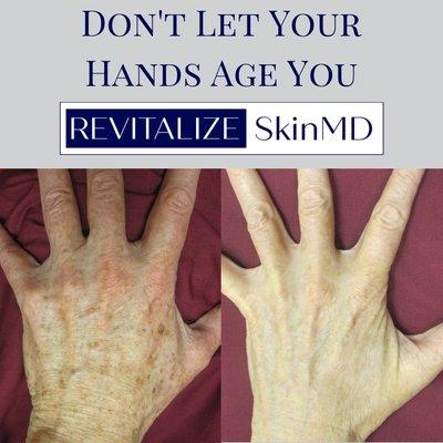 Revitalize SkinMD