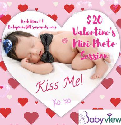 Online only Booking!
No exceptions!
BabyviewUltrasounds.com
Book Now 1/15-2/13!