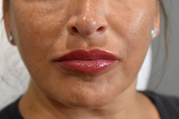 Permanent lip color and filler