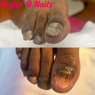 Now accepting HSA payments for medical pedicures!