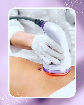 Cavitation weight loss and skin tightening