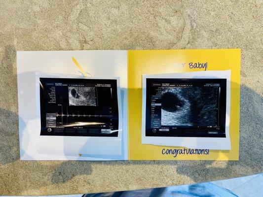 Photo of our baby so excited that it worked the first time