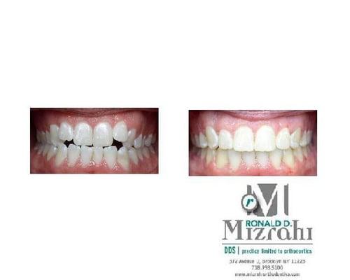 Mizrahi Orthodontics is the BEST practice for your orthodontic care