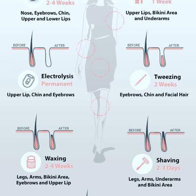 Different types of hair removal