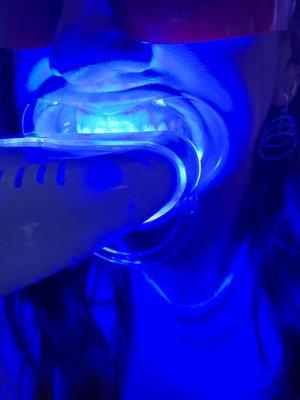 Teeth whitening! It was very hard to keep my mouth for 30 minutes!!! Not worth the money!!!