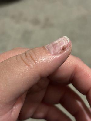 Nail 1- not as damaged as nail 2