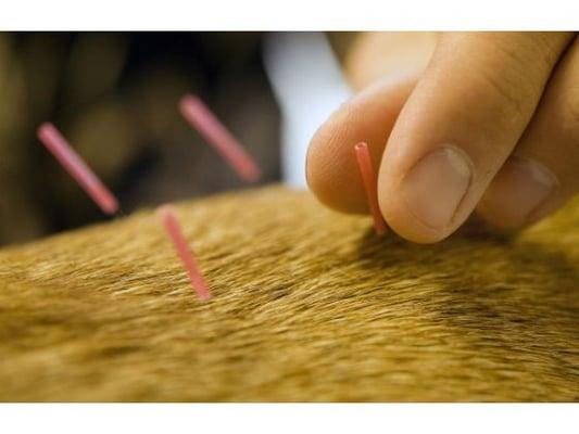 Acupuncture is just one of the alternative options