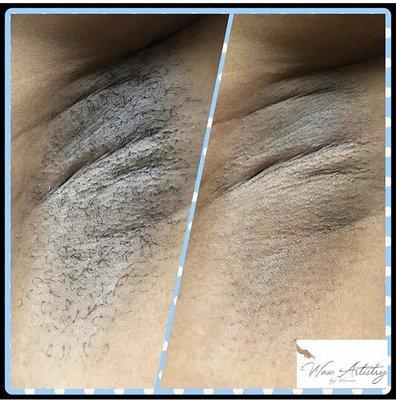 Underarm wax