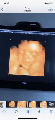 Mommy's Bundle of Joy 4D Ultrasound