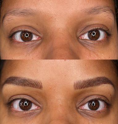 Before and After Combo Brow