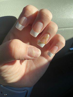 All my nails are falling off