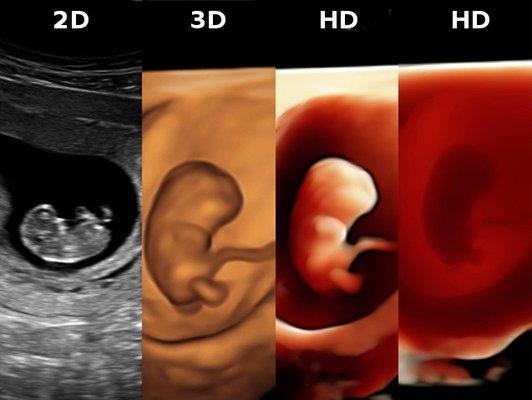 9 week baby images