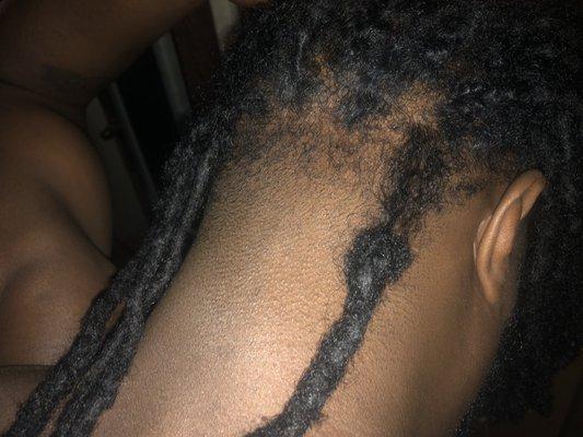 You can see where the loc is thinner by the scalp on the locs hanging down. Four locs damaged by incompetent barbers.