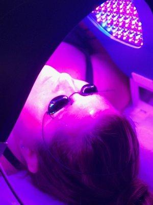 Now offering microneedling with light therapy (photobiomodulation)