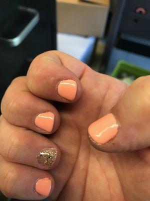 "They look good to me!" --Manager (Owner?) of Nail 1st.  This was after being "fixed."