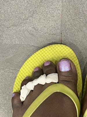 My cute toe's