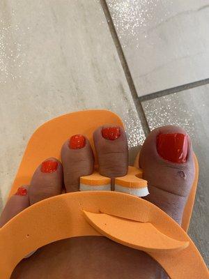 Horrible pedicure