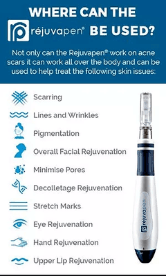 Microneedling is available for anti-aging, reduction of acne scarring and more.