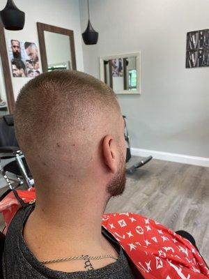 Skin fade