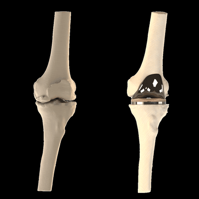 Nano modeling for knees.